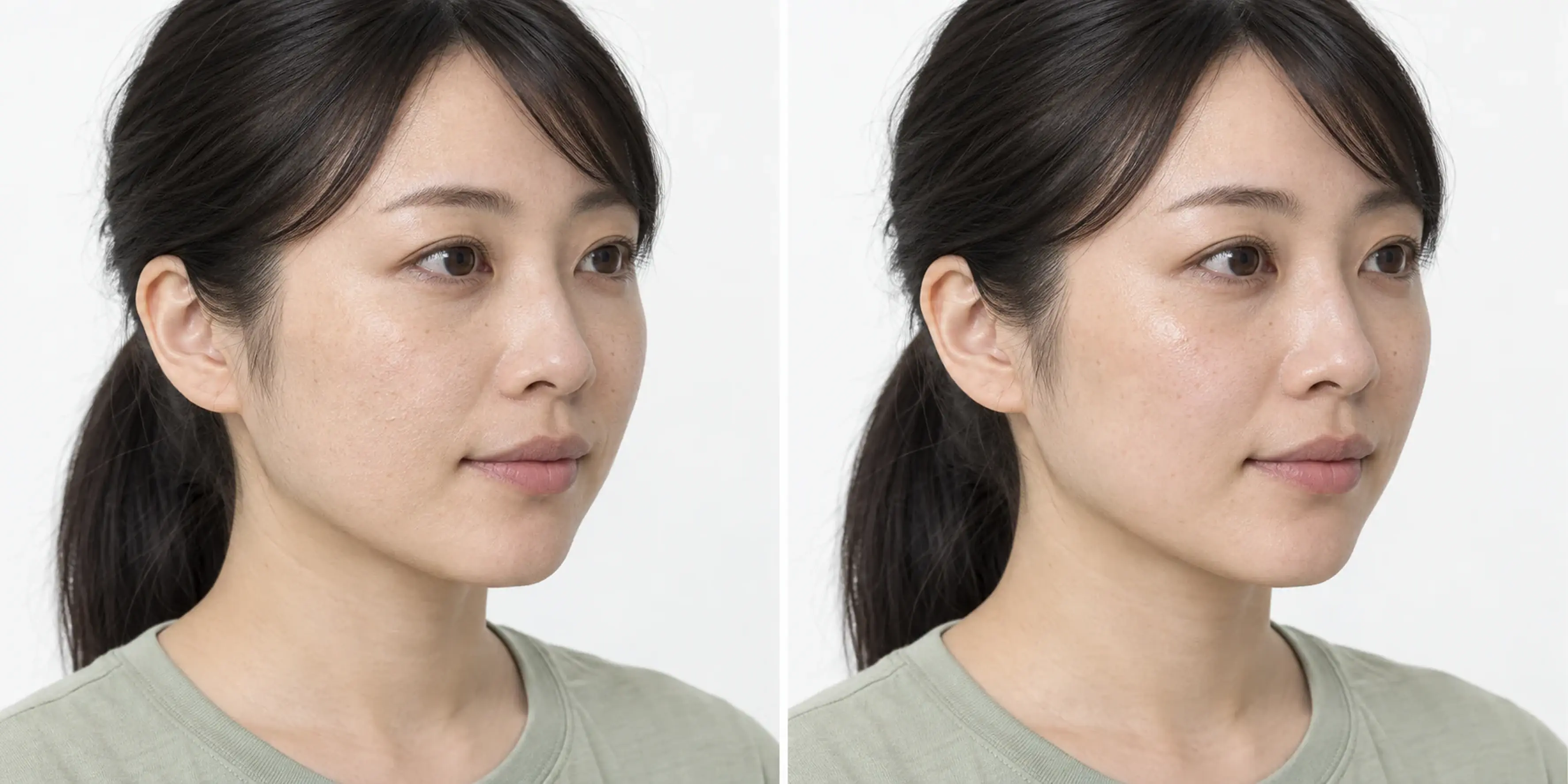 Dry-looking texture in an adult face
