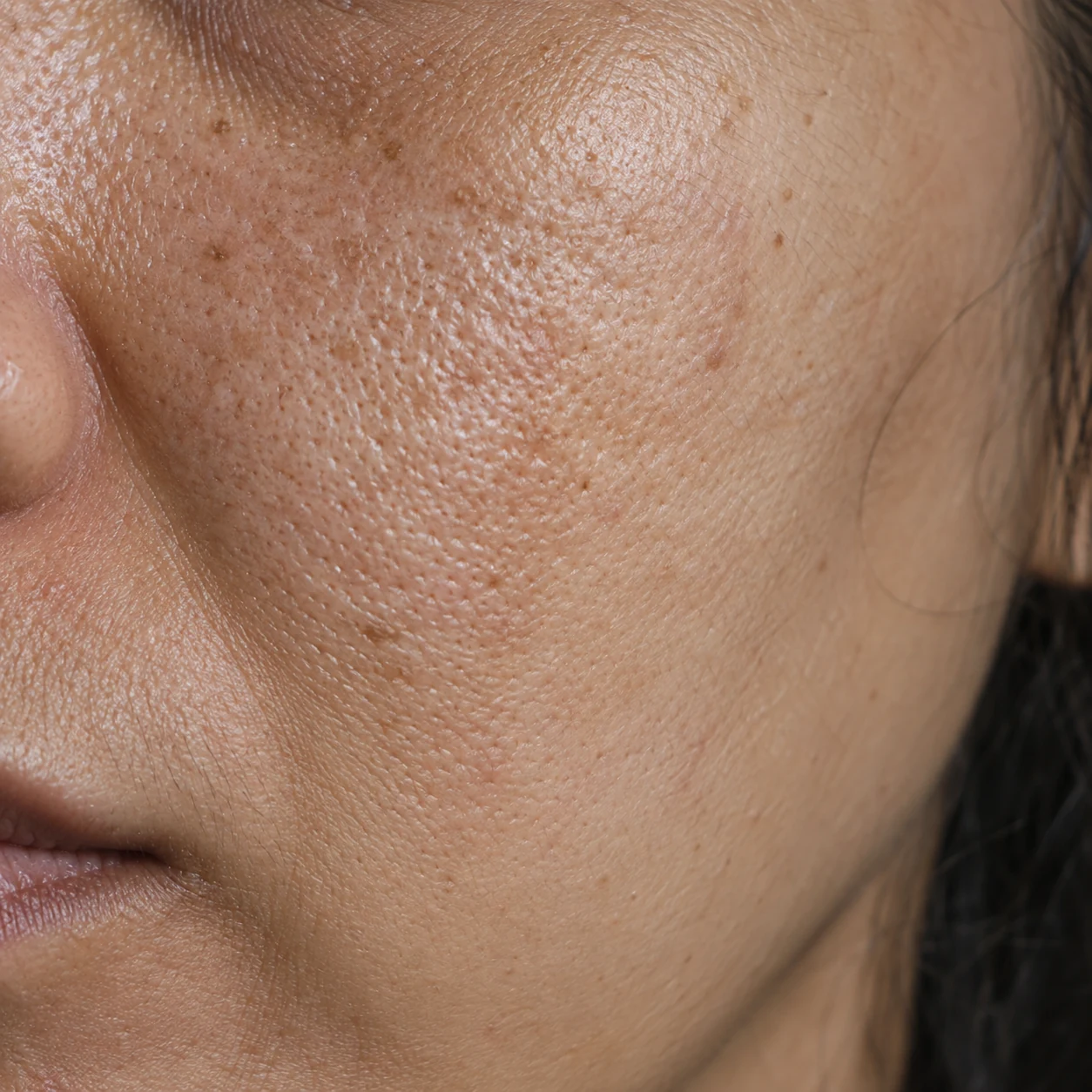Close-up of rough cheek texture
