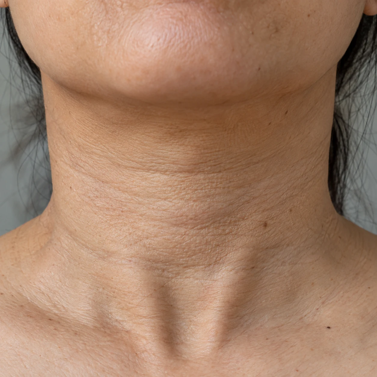 Close-up of neck texture