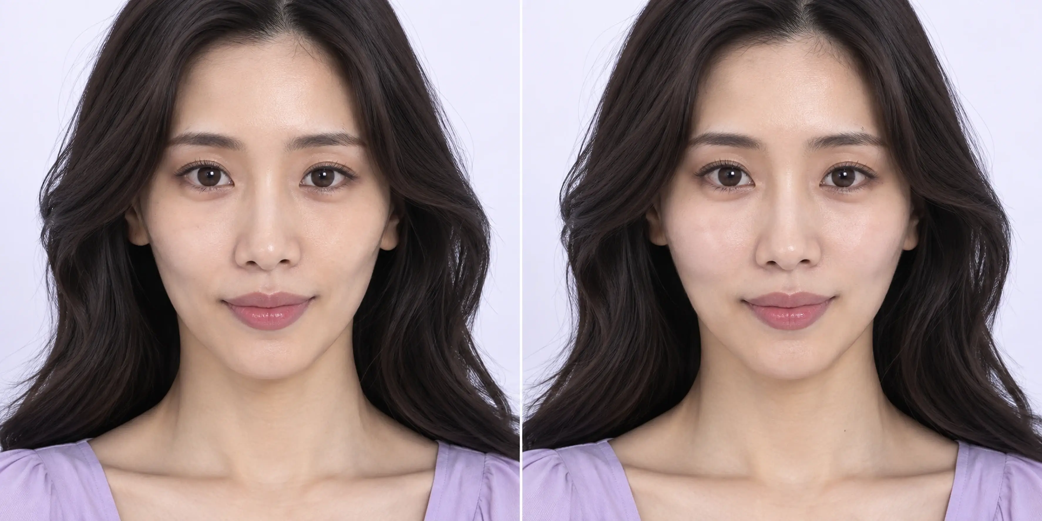 Simulated subtle facial support change in an adult face