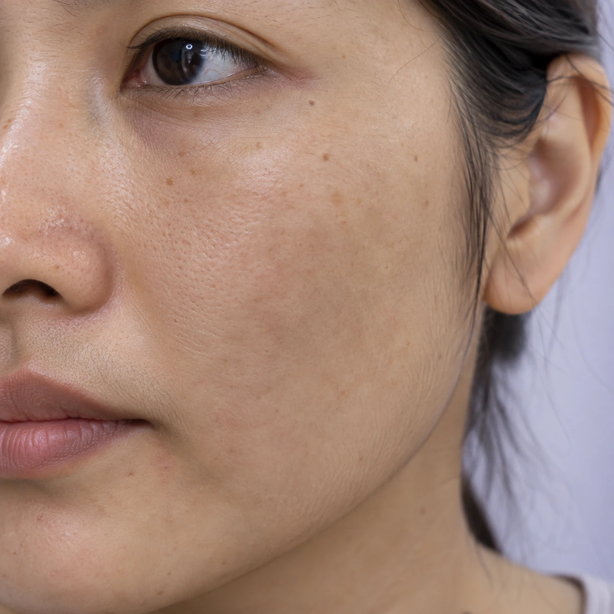 Close-up of dull-looking skin