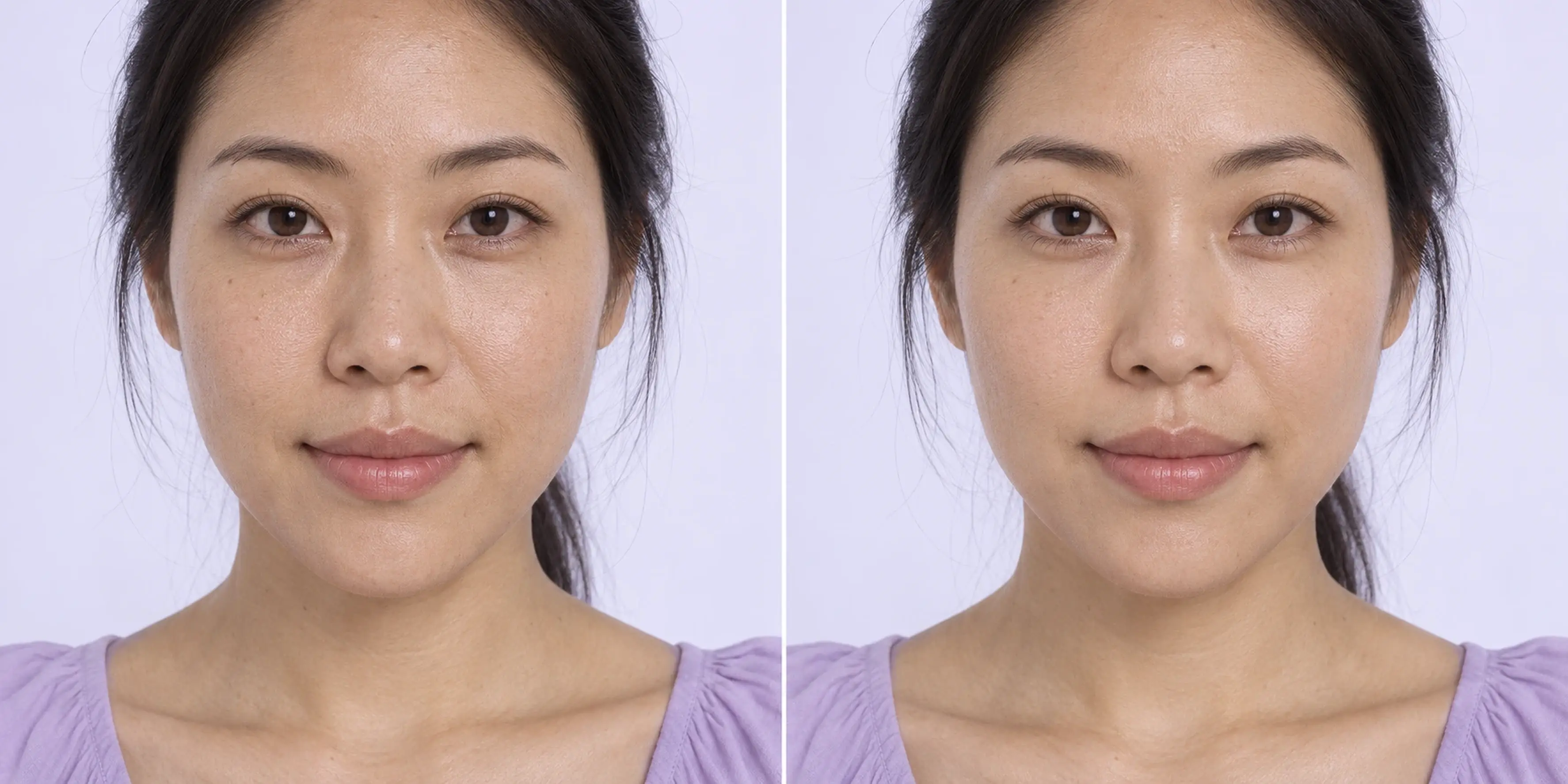 Simulated subtle skin texture change in an adult face