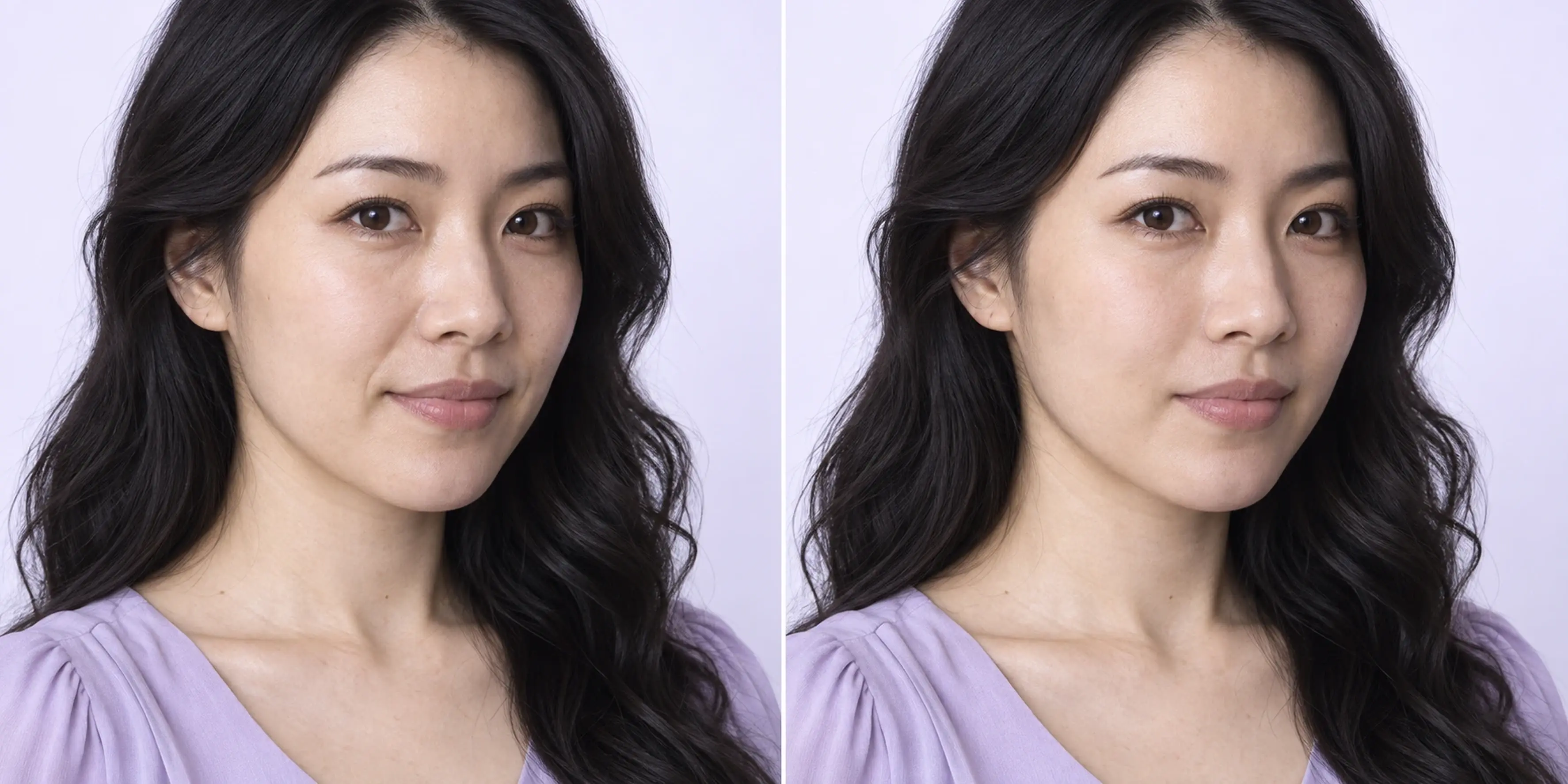 Simulated subtle facial support change in an adult face
