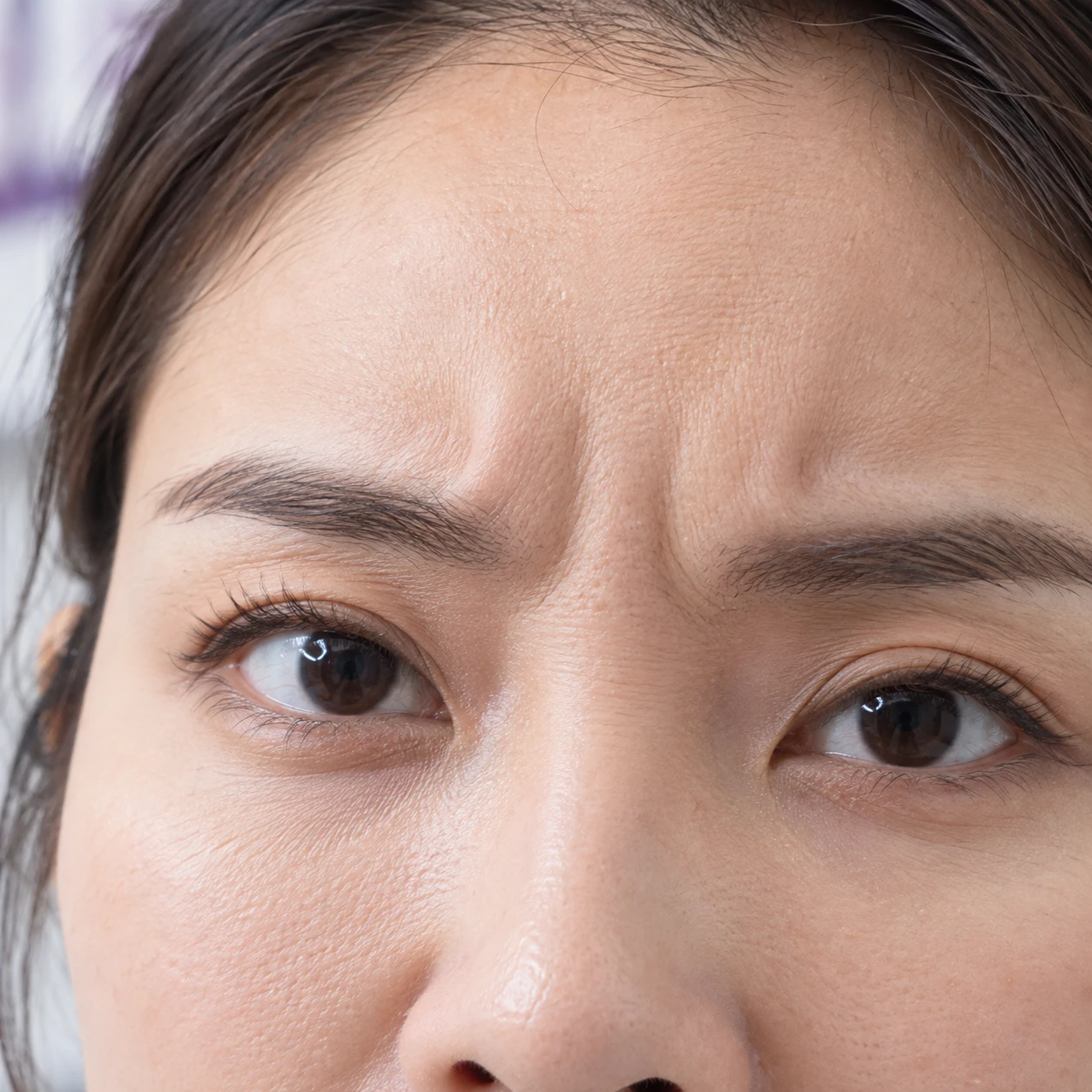 Close-up of frown creases