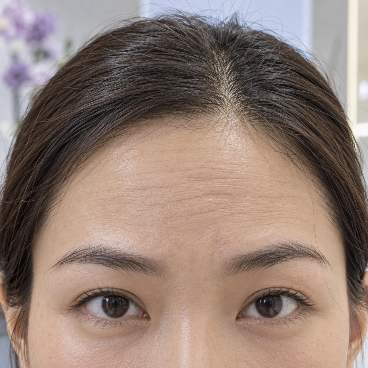 Close-up of forehead movement