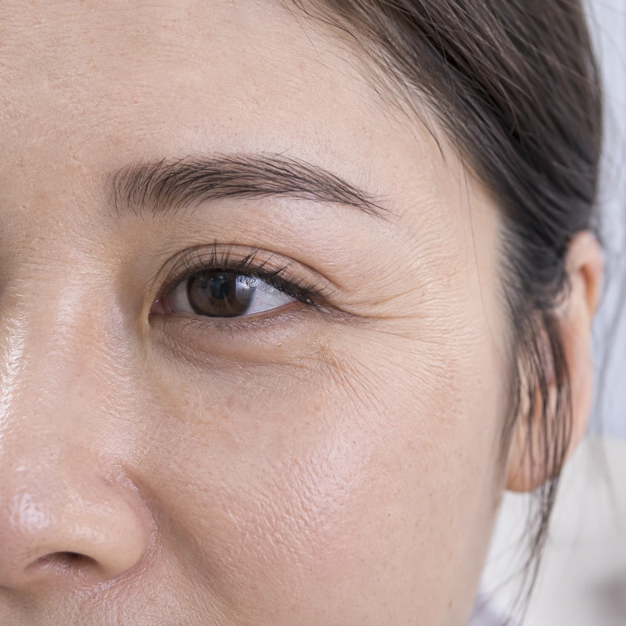 Close-up of smile-related eye lines