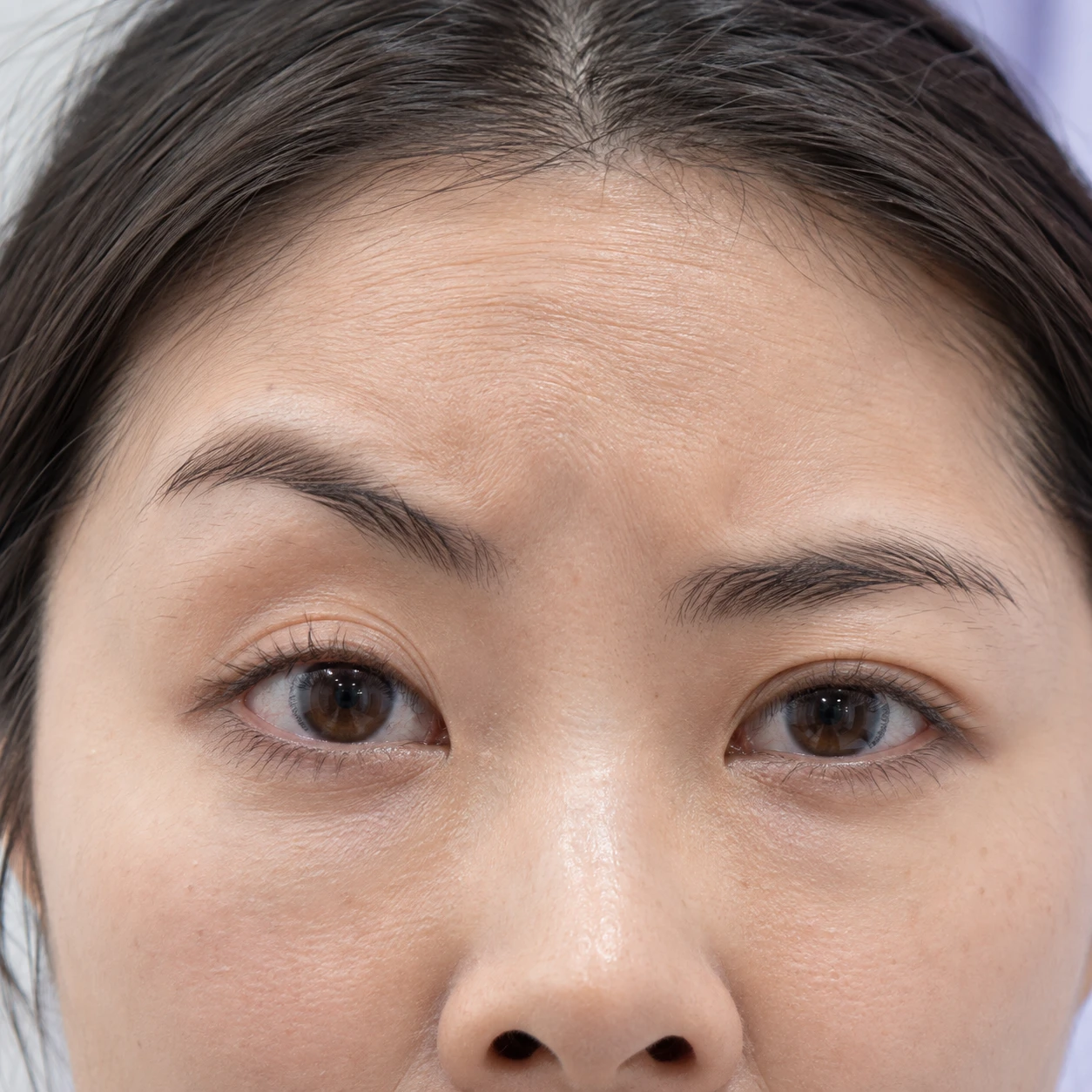 Close-up of uneven brow movement