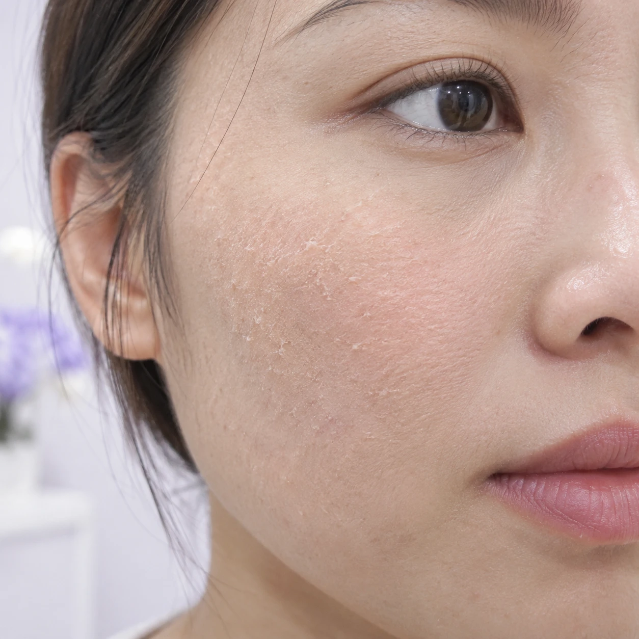 Close-up of dry skin texture