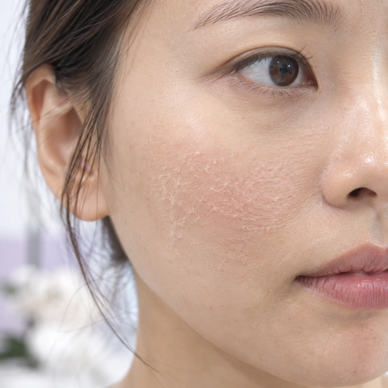 Close-up of dry-looking cheek