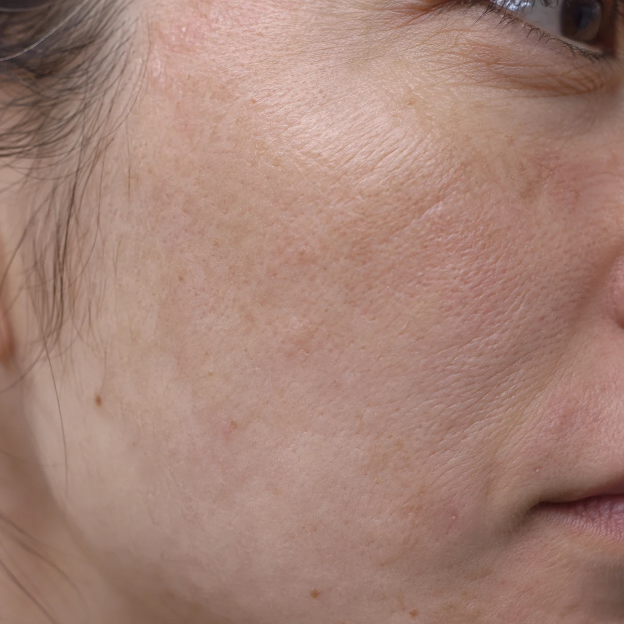 Close-up of fine cheek lines
