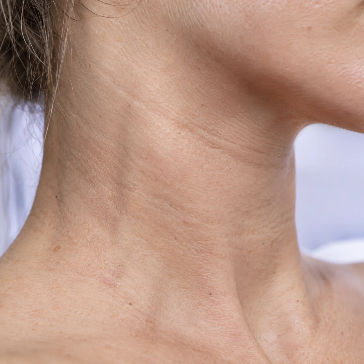 Close-up of crepey neck texture