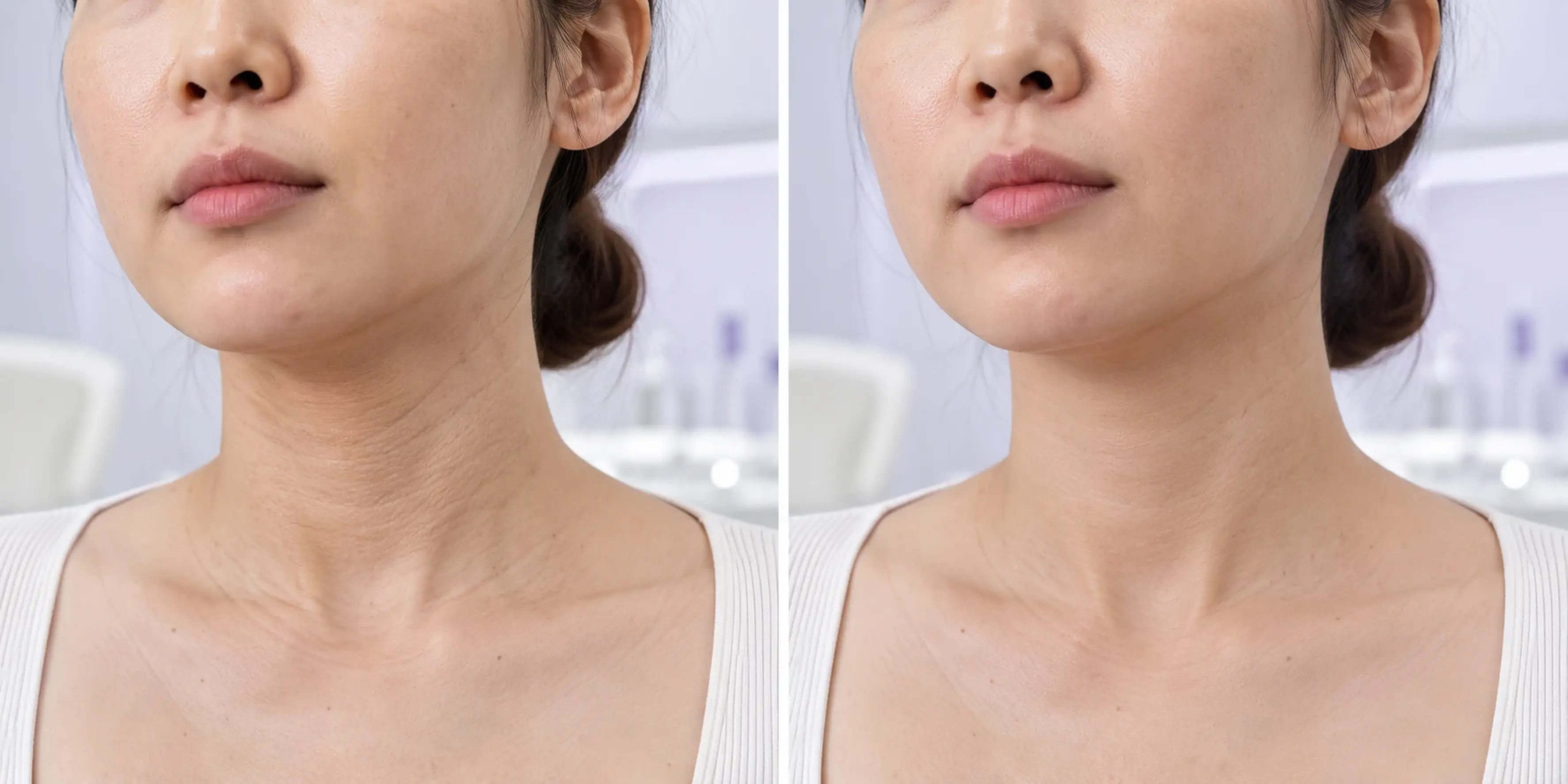 Visible surface texture in an adult face