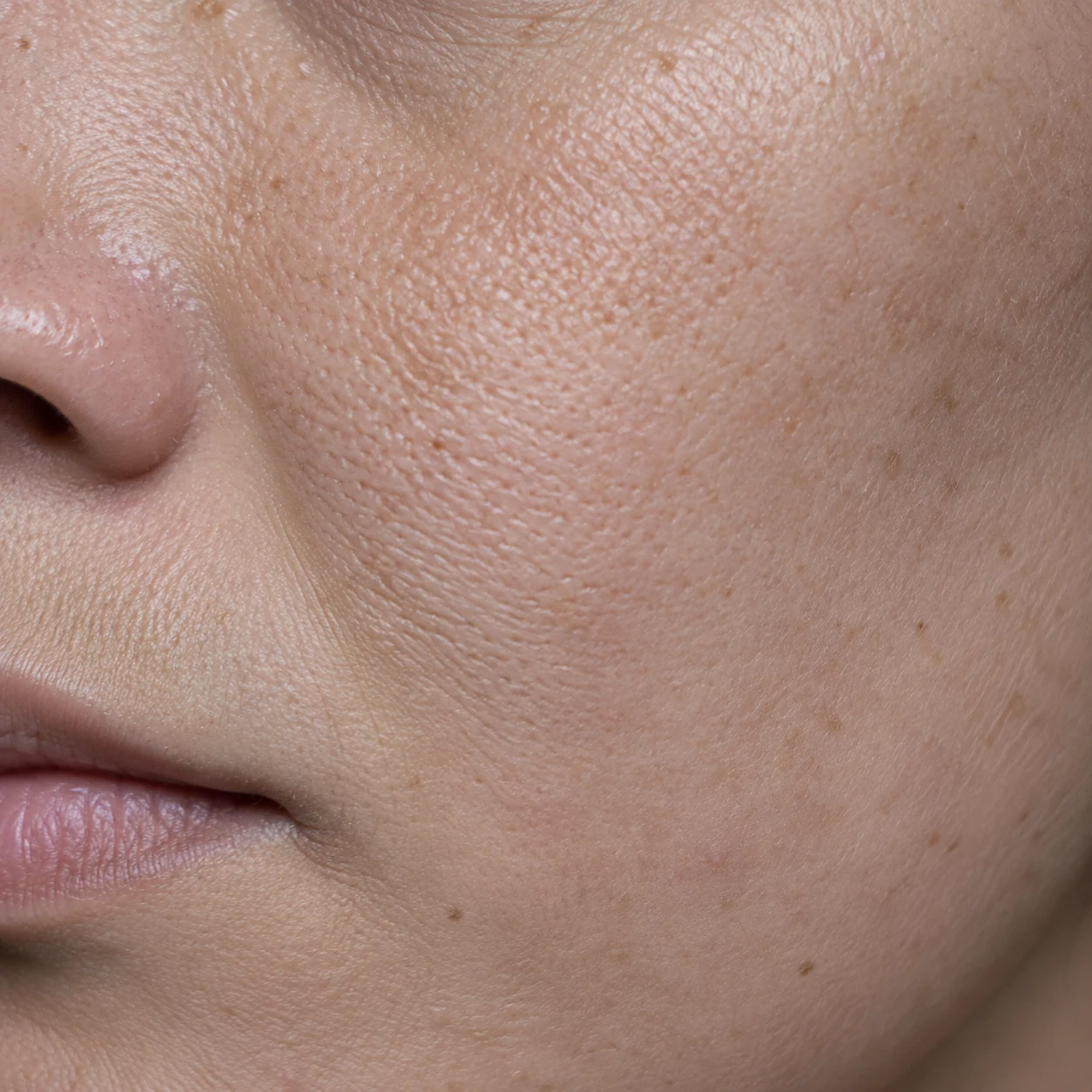 Close-up of dull-looking skin