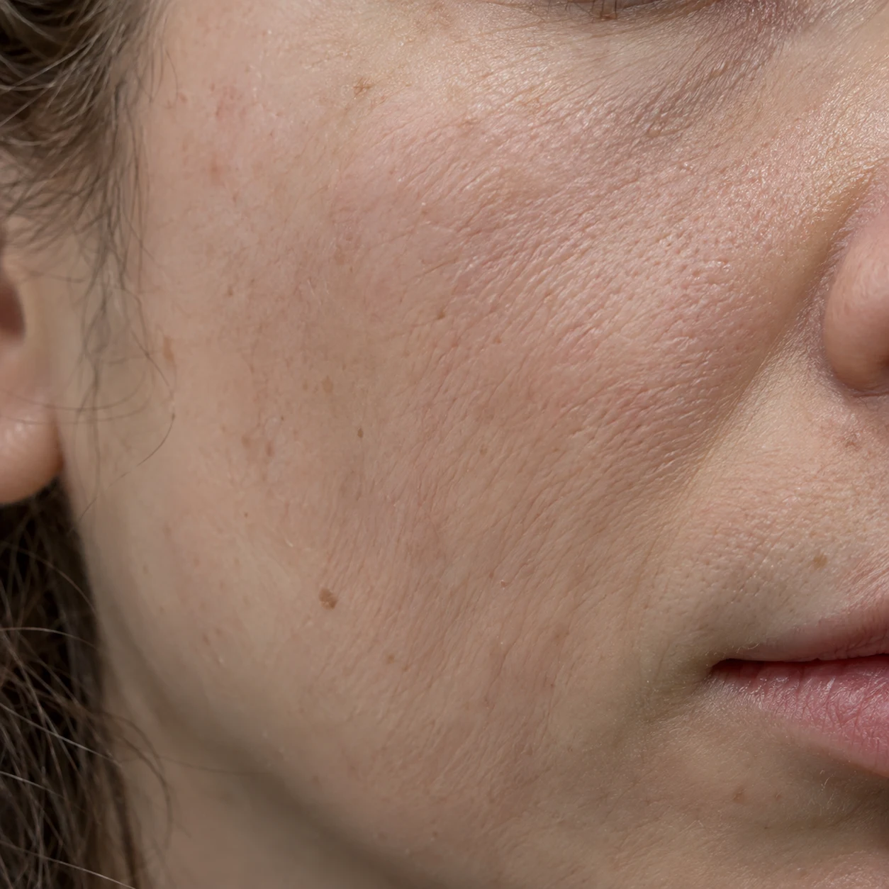 Close-up of crepey cheek