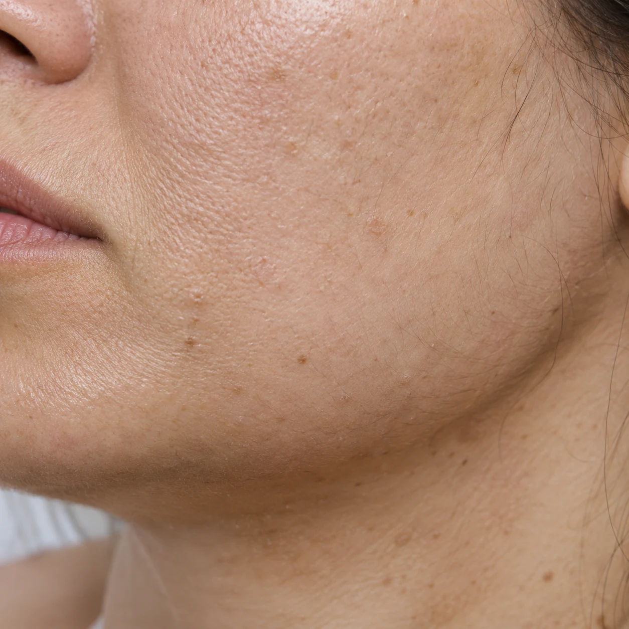 Close-up of soft jaw transition