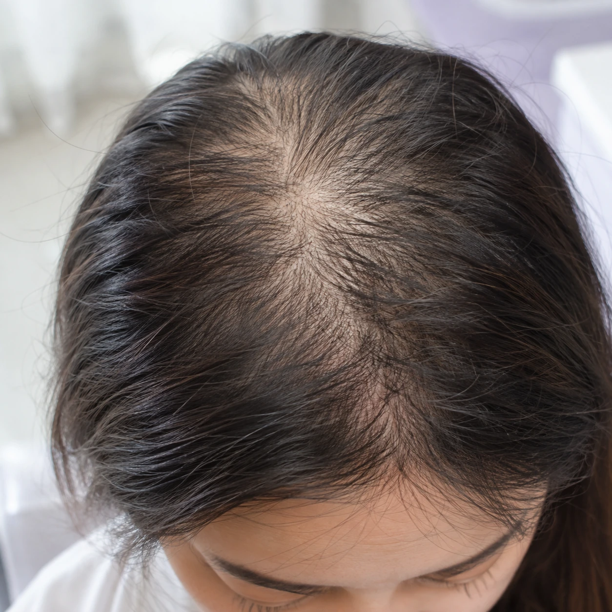 Close-up of diffuse crown thinning