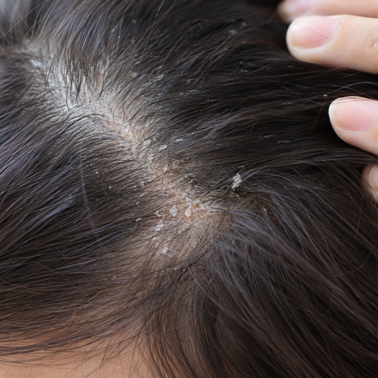ARCHE Hair & Scalp Care — illustrative consultation photograph