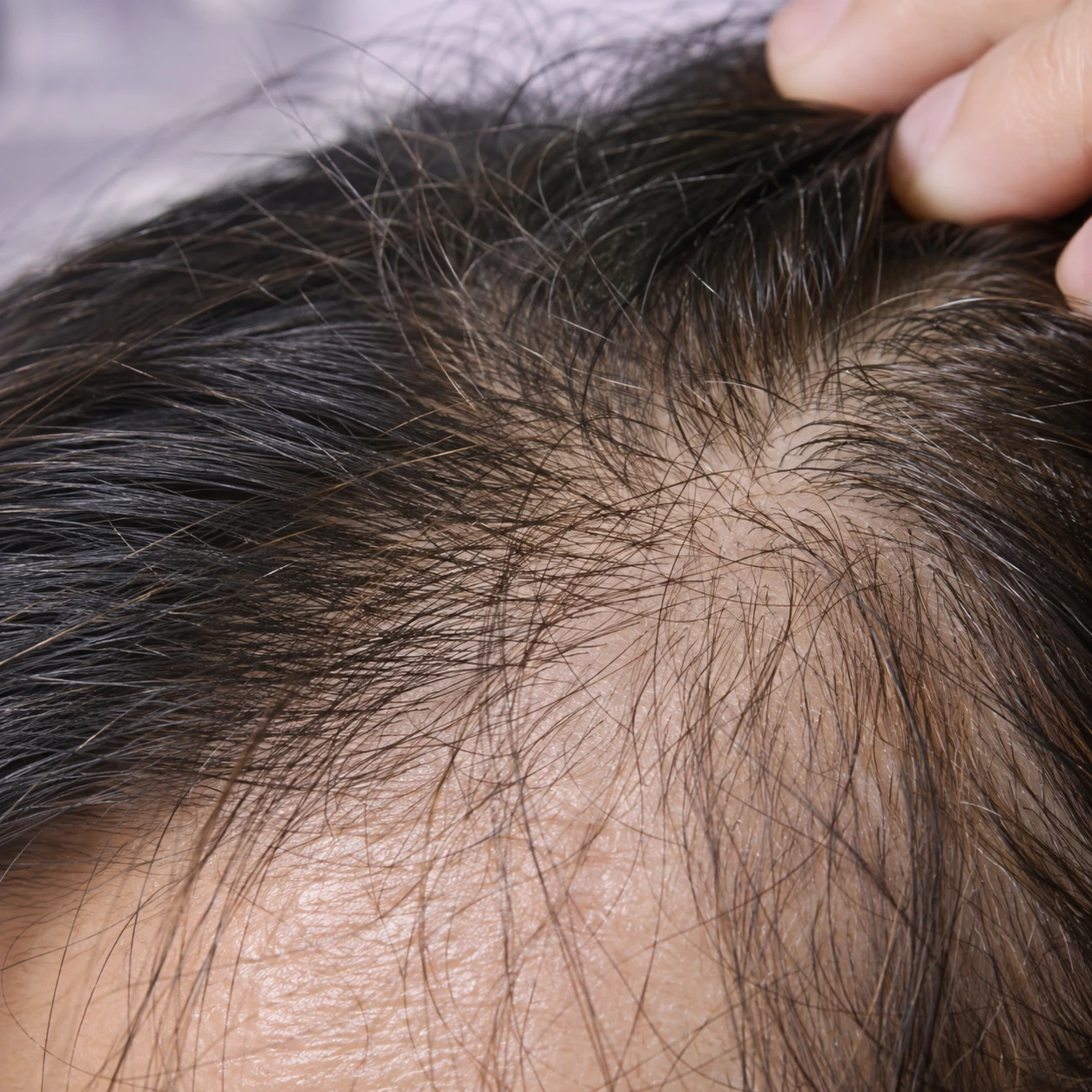 ARCHE Hair & Scalp Care — illustrative consultation photograph