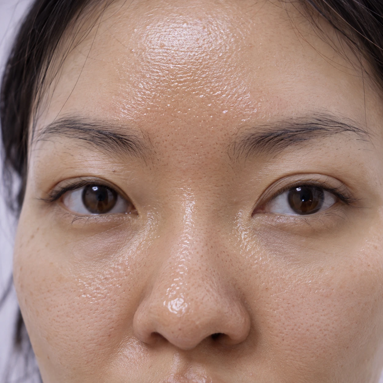 Close-up of oily t-zone