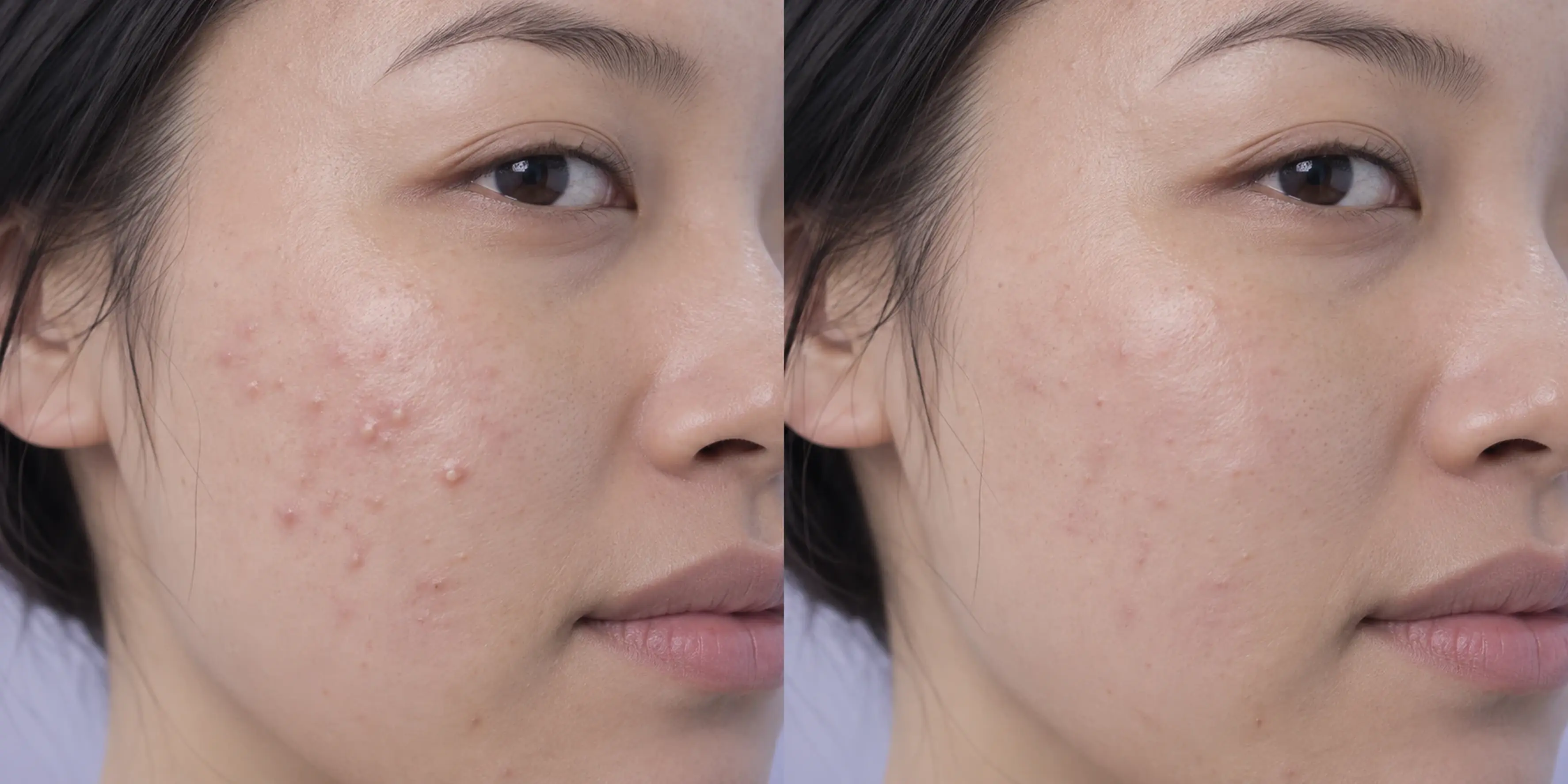 More visible congestion in an adult face