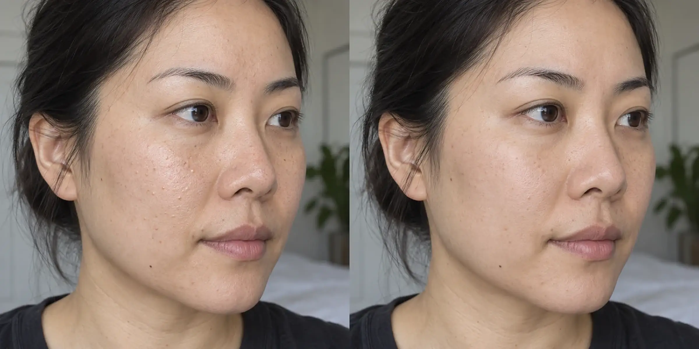 More visible congestion on an adult patient’s skin