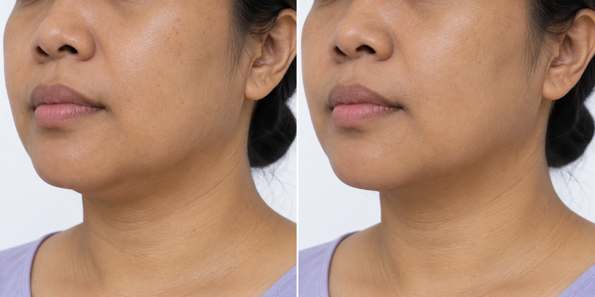 Visible skin texture in an adult face