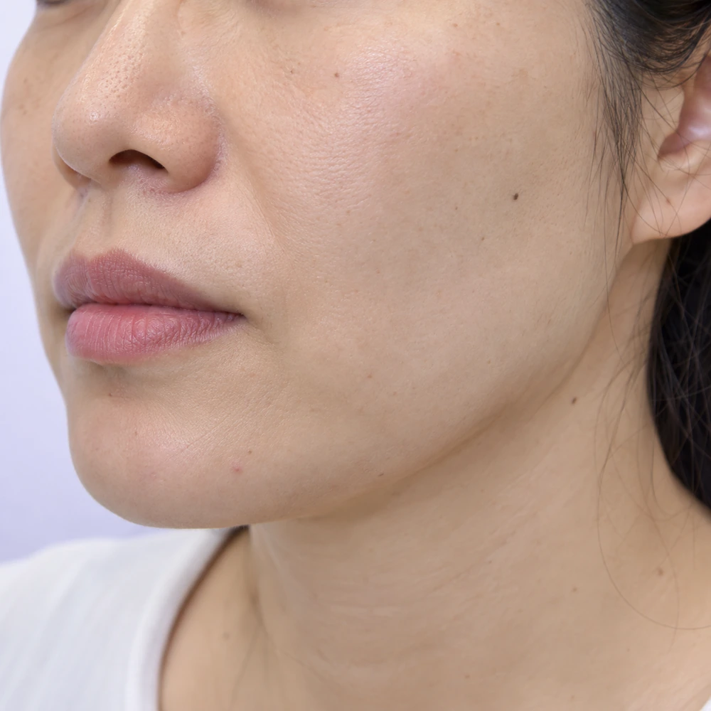 Close-up of early jowl change