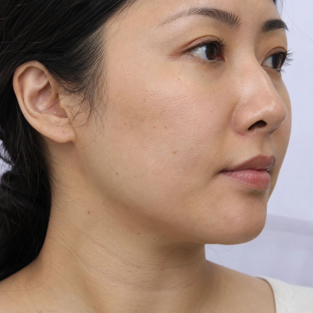 Close-up of jawline definition