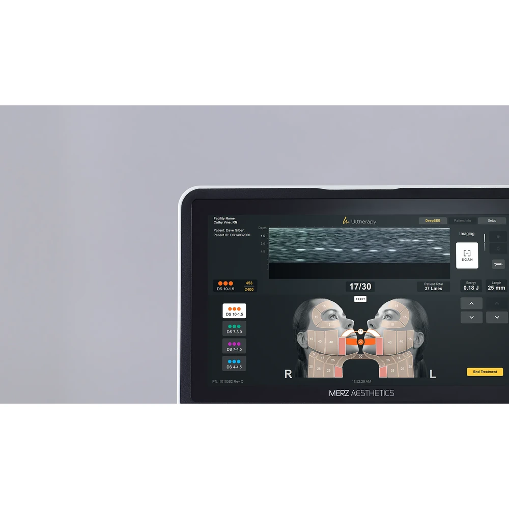 Ultherapy PRIME 主機與演示屏製造商特寫;診所採用的型號及所有權尚未確認