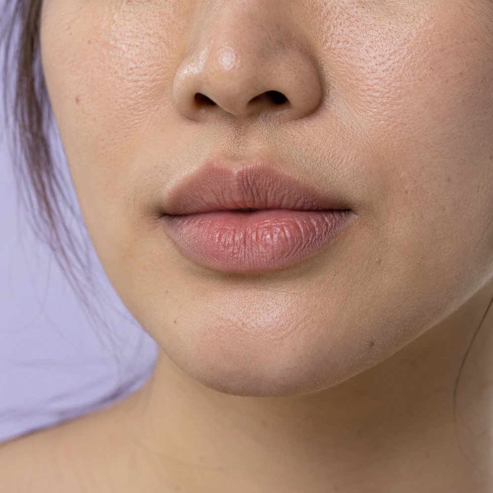 Close-up of uneven lip surface