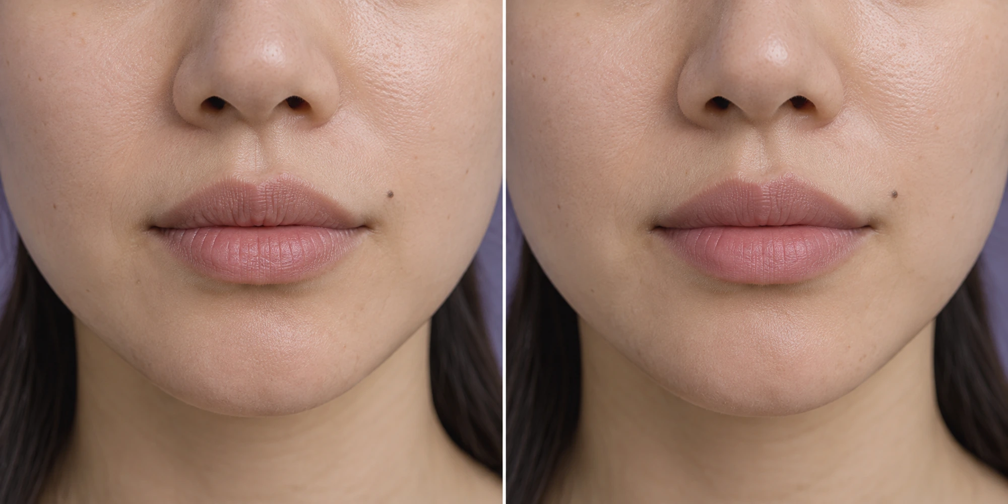 Fine lip and perioral texture in an adult face