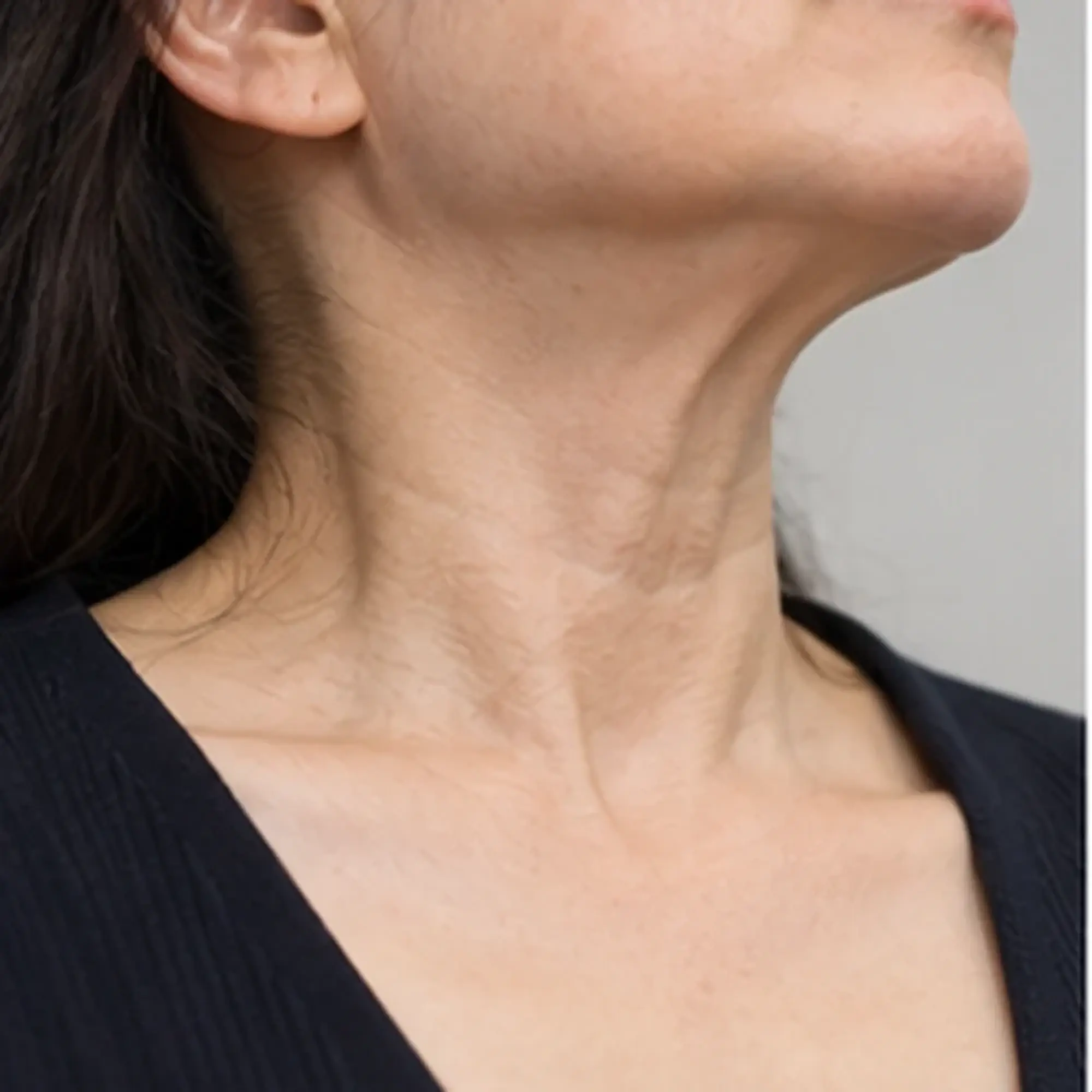 Reference image for Complication and insurance plan