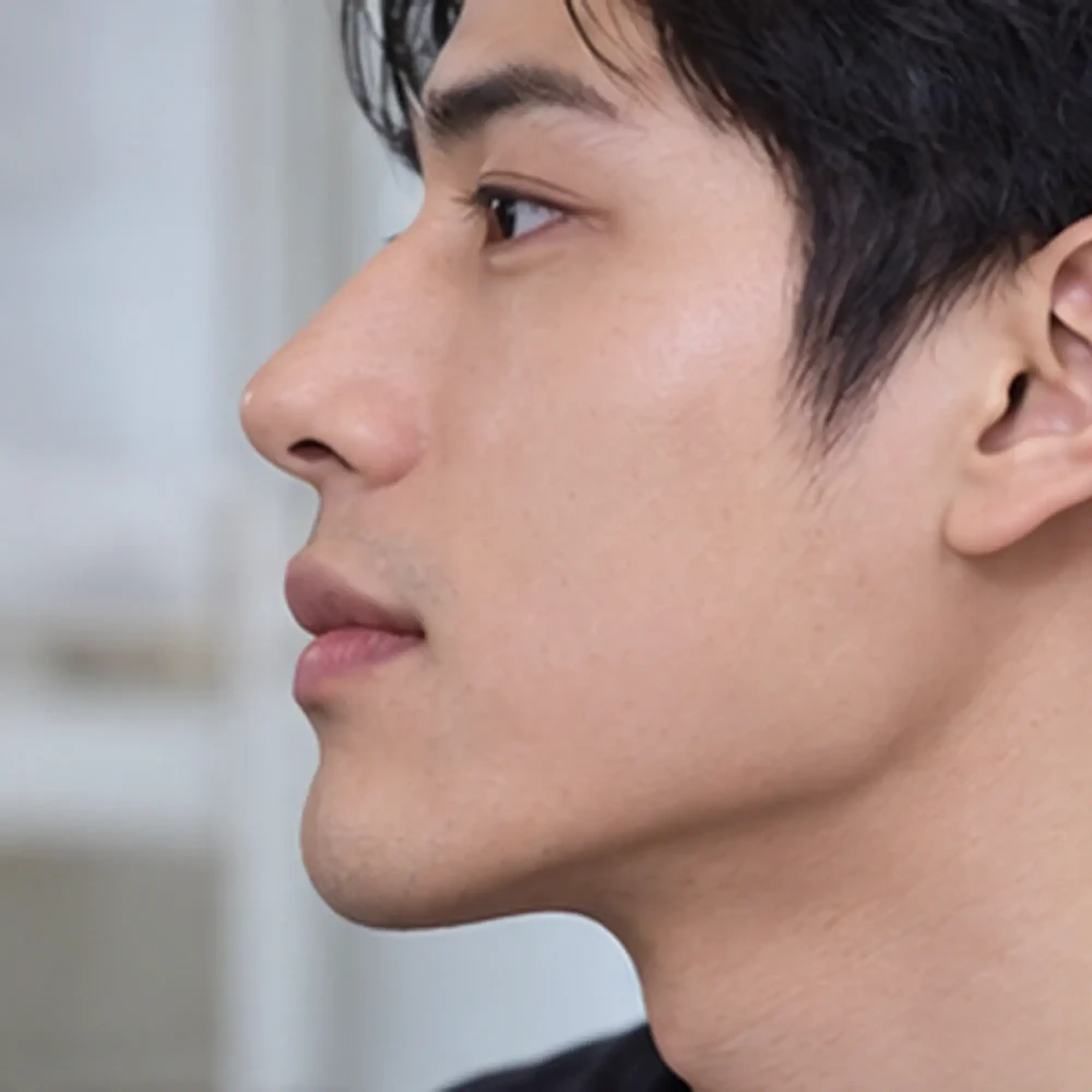 Reference image for Facial asymmetry