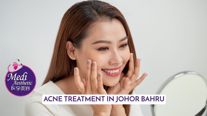 Clear Skin, Confident You Understanding Effective Acne Treatment Johor Bahru