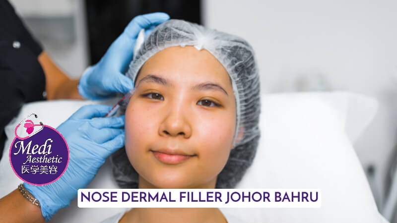 Nose Dermal Filler Enhancing Your Nasal Features With Precision Johor Bahru