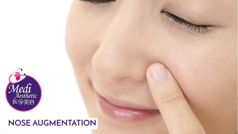 The Perfect Balance Enhancing Your Features With Nose Augmentation