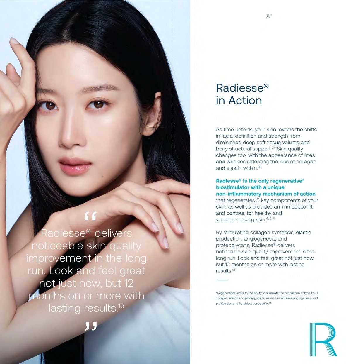Before and after Radiesse skin treatment near Singapore by Medi Clinic for Singaporean patients