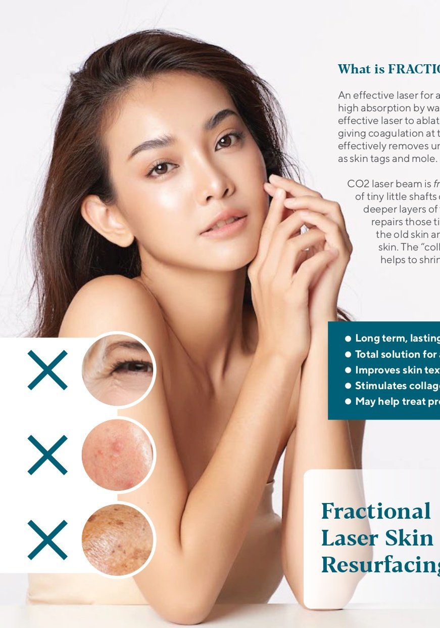 CO2 laser large pore and texture treatment for improved skin quality in Johor Bahru, trusted by Singapore patients