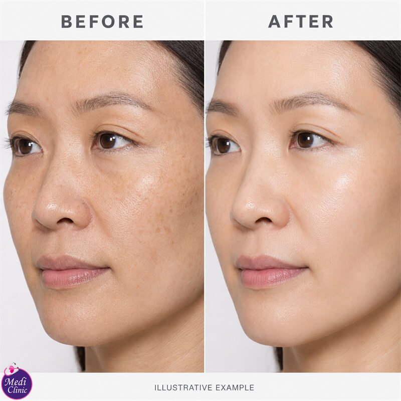 Doctor explaining CPM hyaluronic acid technology JB SG Doctor explaining CPM hyaluronic acid technology JB SG